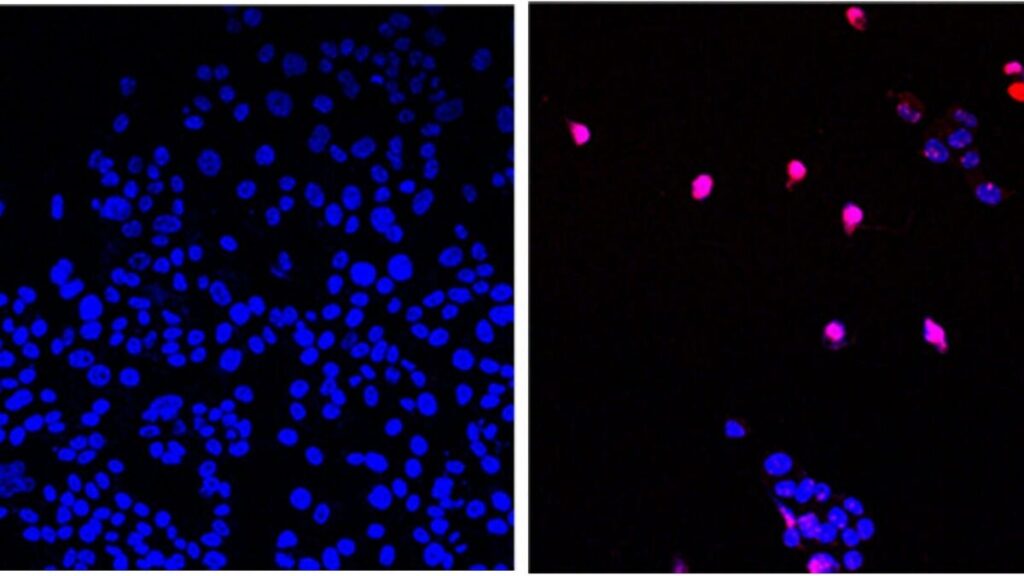 pilula anticancer