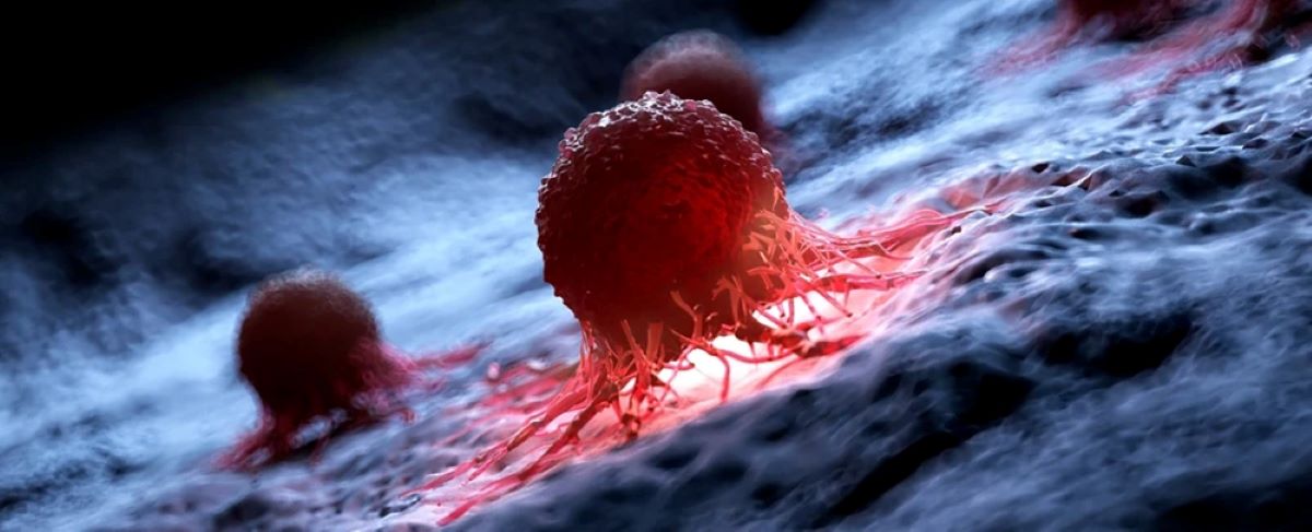 celule cancer